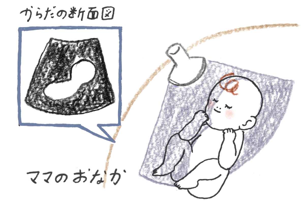 医師監修 エコー写真ってどう見るの ３d ４dエコーって何 ゼクシィbaby